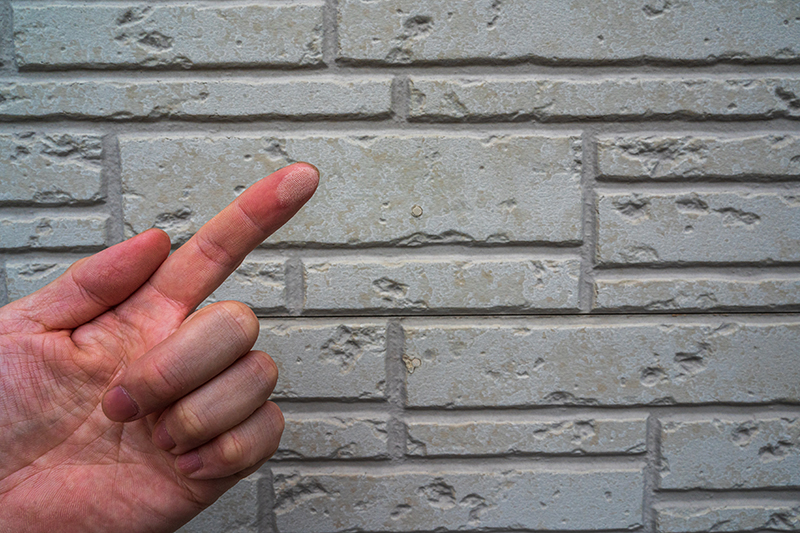 こんな症状が出ていたら要注意！